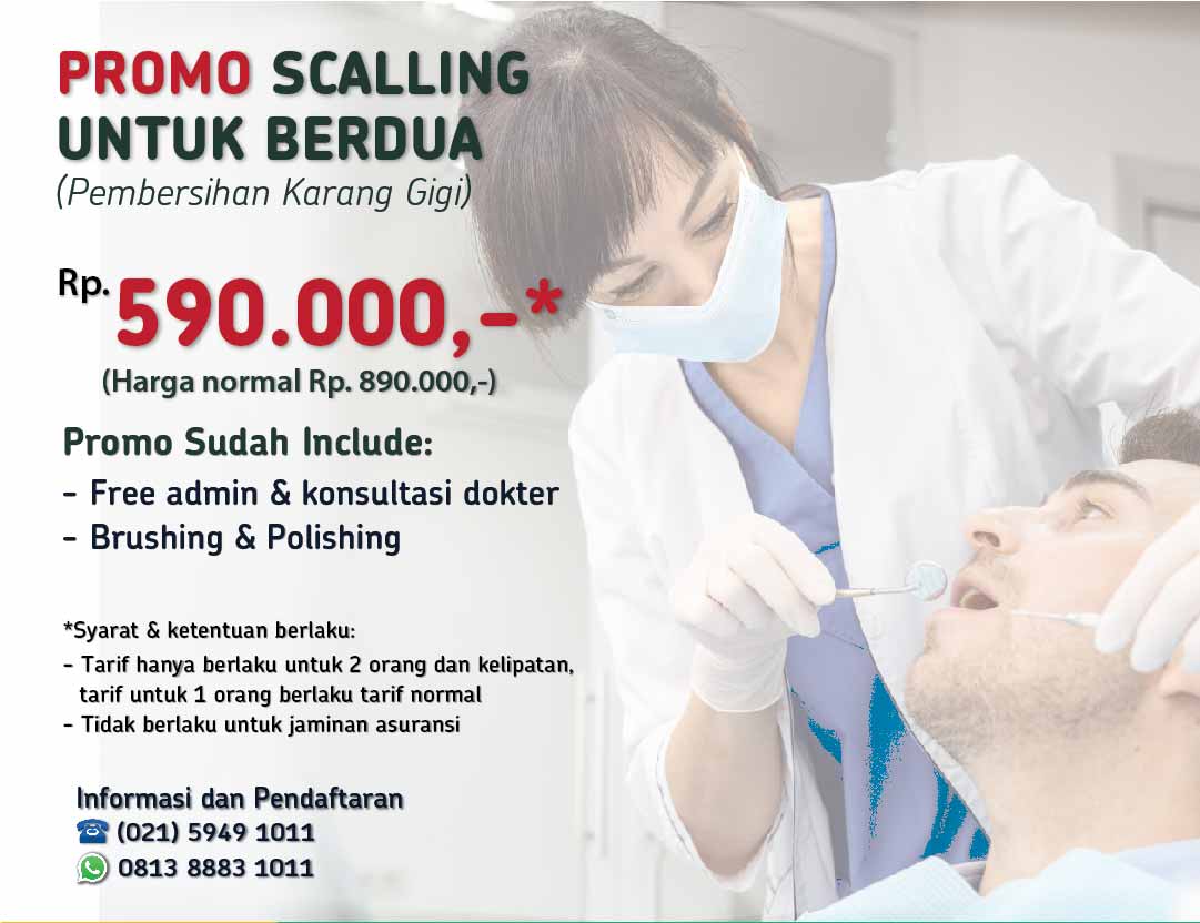 promo scalling gigi